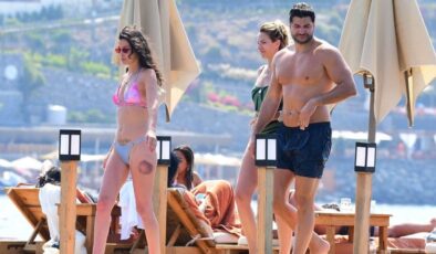 Müjde Uzman Bodrum Tatilinde Objektiflere Takıldı: Bacağındaki Morluk Dikkat Çekti