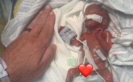 Doktorlar ‘yaşamaz’ demişti! 280 gram doğan bebekten dünya rekoru