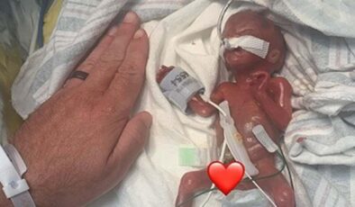 Doktorlar ‘yaşamaz’ demişti! 280 gram doğan bebekten dünya rekoru