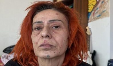 Yıldız Tilbe ilk kez hastalığını açıkladı! Doktorunun yasağı şaşırttı