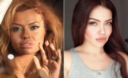 Ünlü şarkıcı Lara’dan üzen haber: Beynimde kitle belirlendi Allah’ın izniyle bu sınav bitecek!