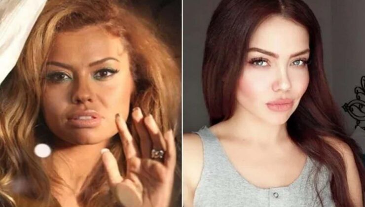 Ünlü şarkıcı Lara’dan üzen haber: Beynimde kitle belirlendi Allah’ın izniyle bu sınav bitecek!
