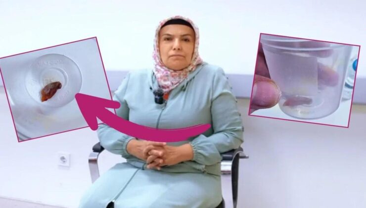1,5 yıldır durmadan öksüren kadının boğazından çıkan herkesi şoke etti!