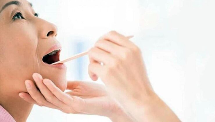 Dilindeki ağrıyı önemsemedi! Ancak sanılandan çok daha ciddi çıktı