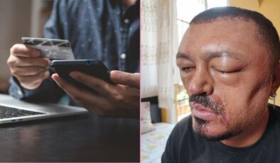 Saçlarını karartacakken, hayatı karardı! Sahte güzellik ürünlerine dikkat