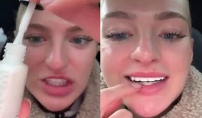 Dişlerini beyazlatmak isteyen kadının kullandığı yöntem ‘yok artık’ dedirtti!