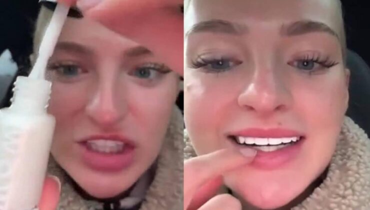 Dişlerini beyazlatmak isteyen kadının kullandığı yöntem ‘yok artık’ dedirtti!