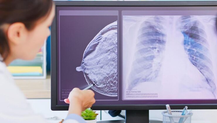 Kanser tedavisinde devrim: Kişiye özel tedavi dönemi başladı
