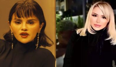 Selena Gomez estetiğin dozunu fazla kaçırdı: Son hali Ceylan’a benzetildi