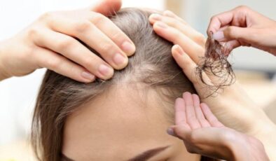 Sonbahar geldi, saçlar dökülmesin! Sonbaharda saç dökülmesini önlemenin doğal yolları