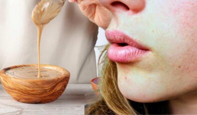 Tahin ve balın mucizesi: Kışın kuruyan ciltler için viral olan yöntem