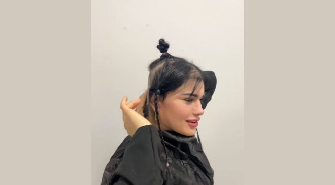 TikTok Fenomeni Hülya Mizgin’in Saçları Estetik Kurbanı!