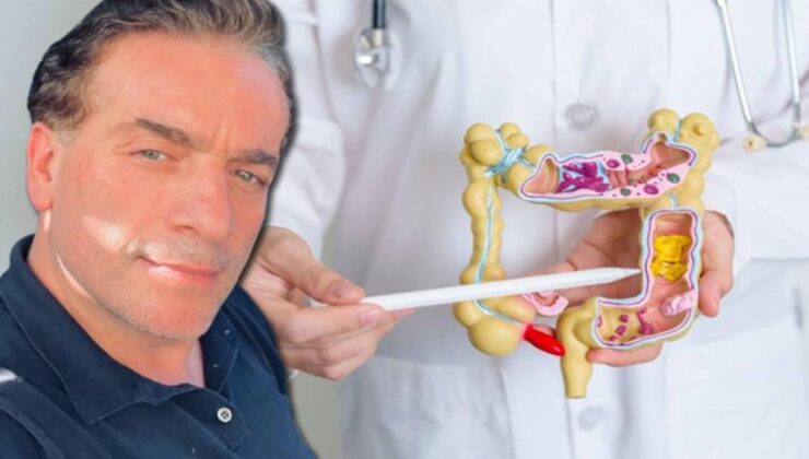 Murat Cemcir’i yoğun bakımlık eden hastalık divertikül kanaması nedir?