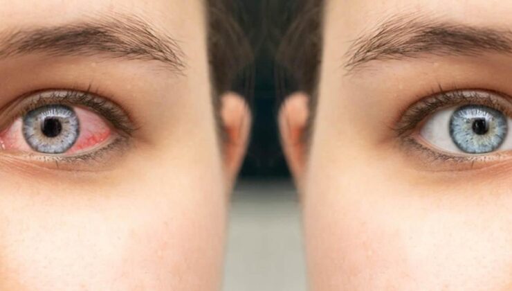 Uzmanı uyarıyor: Kış aylarında soğuk hava ve kapalı ortamlar, göz sağlığını tehdit ediyor!