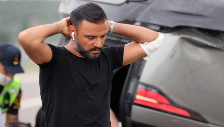 Alişan’dan beklenmedik botoks itirafı!