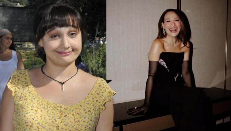 Gupse Özay’ın hastalığı gündem oldu! Hızlı kilo kaybınızın sebebi ülseratif kolit olabilir