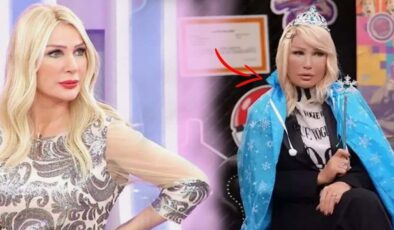 Seda Sayan’ın yüzü tanınmaz halde! Nedenini ilk kez açıkladı