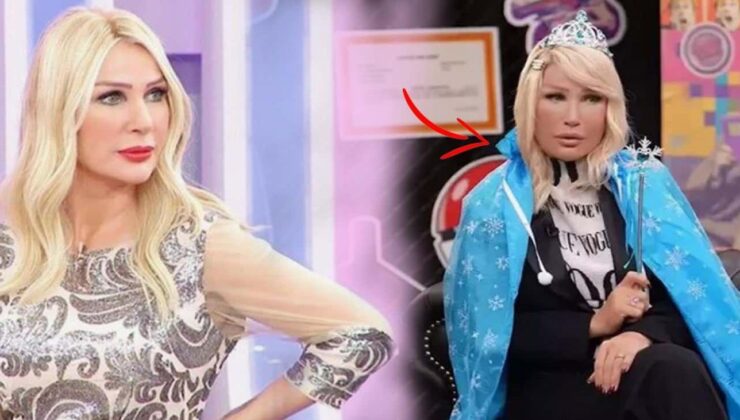 Seda Sayan’ın yüzü tanınmaz halde! Nedenini ilk kez açıkladı