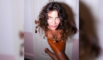 Berrak Tüzünataç Estetikleri Hakkında Şok Gerçekler Neler?