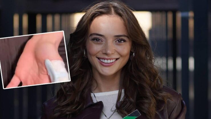 Rabia Soytürk sette kaza geçirdi! Parmağı kopma noktasına geldi