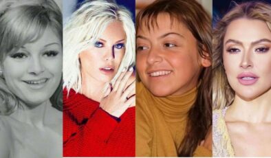 Ünlülerin Dudak Uçuklatan Estetik Değişimleri
