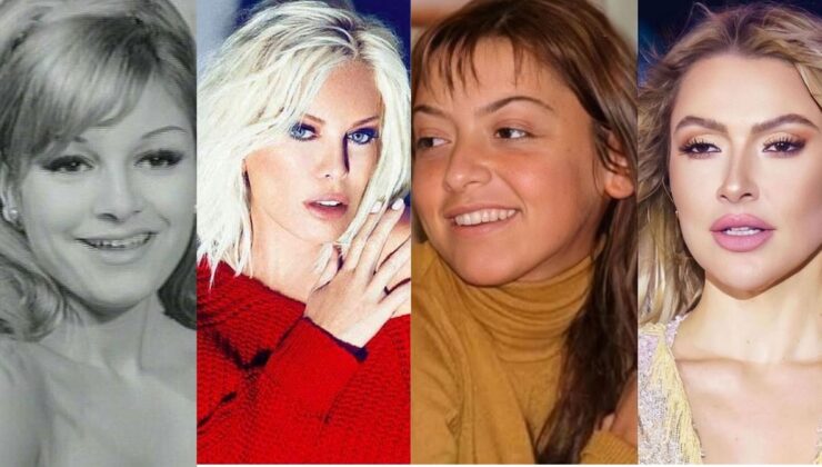 Ünlülerin Dudak Uçuklatan Estetik Değişimleri