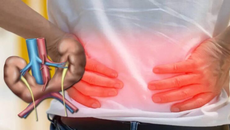 At nalı böbrek: Her 400 doğumda görülen belirti vermeyen böbrek anomalisi ve riskleri