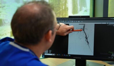 Kritik uyarı: Bacağınız kalp krizi geçiriyor olabilir mi?