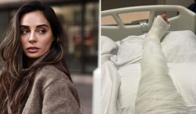 Talihsiz bir kaza geçirmişti! Hepsi’nin yıldızı Yasemin Yürük son durumunu paylaştı