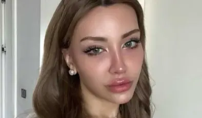 Mika Raun Gerçek İsmi Ne?