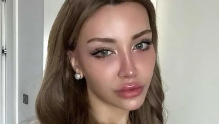 Mika Raun Gerçek İsmi Ne?