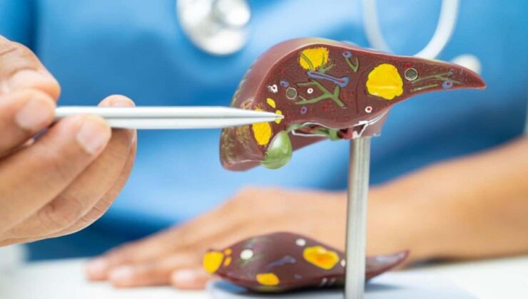 Nefes darlığı ve karın şişkinliğiyle geldi: 20 santimetrelik dev kist ameliyatla çıkarıldı!