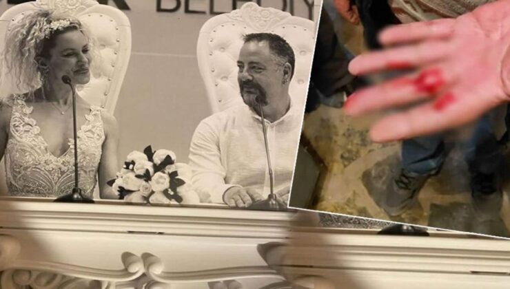 Yıldız Asyalı’nın eş kabusu büyüyor: Babamı da darp etti!