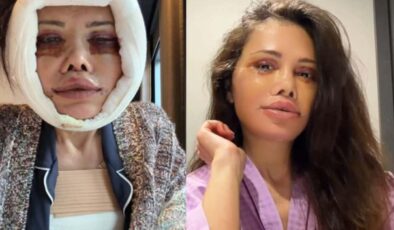 Kore’de yüz nakli geçirmişti! Didem Ceran’ın yüzü ile ilgili sorduğu soru gündem oldu
