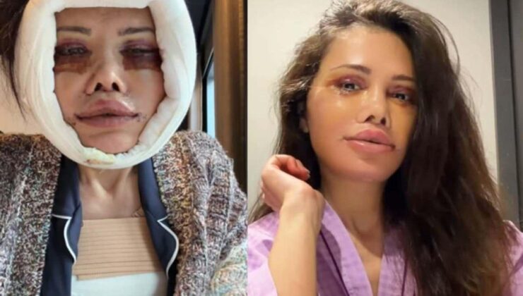 Kore’de yüz nakli geçirmişti! Didem Ceran’ın yüzü ile ilgili sorduğu soru gündem oldu