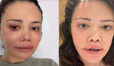 Yüz nakli olan Didem Ceran’ın gençlik sırrı yumurta çıktı!